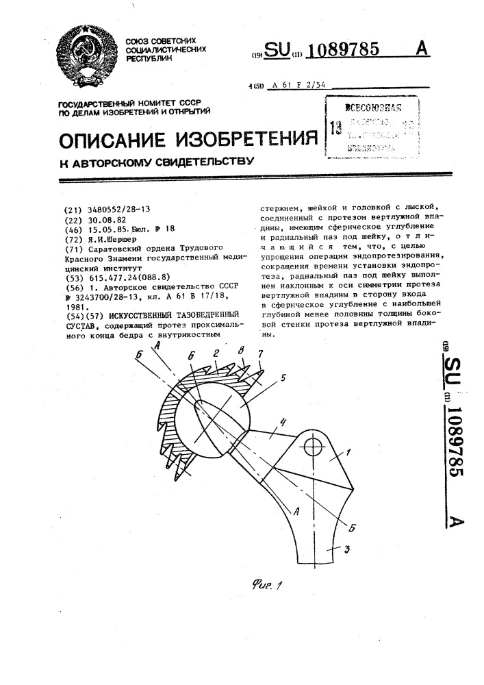 Искусственный тазобедренный сустав (патент 1089785)