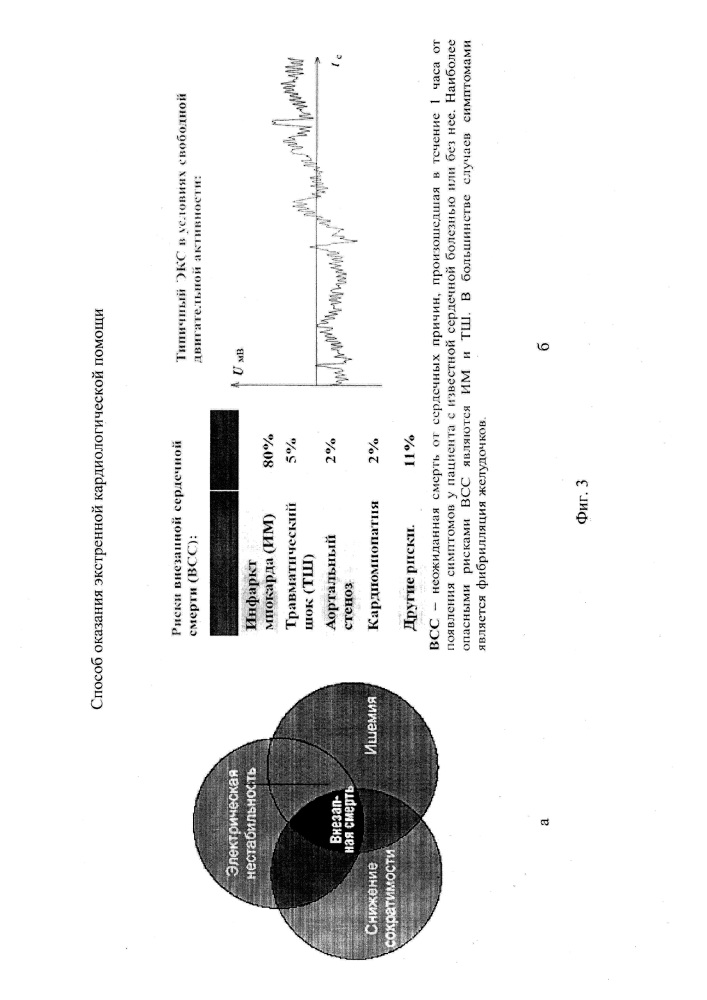 Способ оказания экстренной кардиологической помощи (патент 2644303)