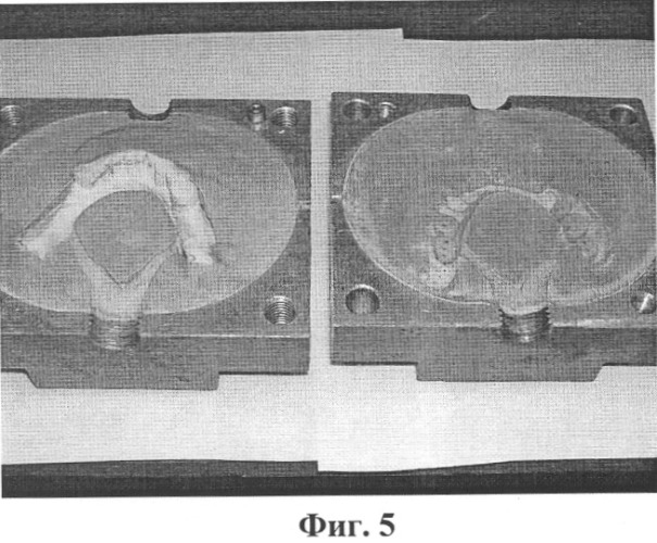Способ изготовления съемных ортопедических конструкций методом инжекционного литья с использованием дополнительных каналов (патент 2320291)
