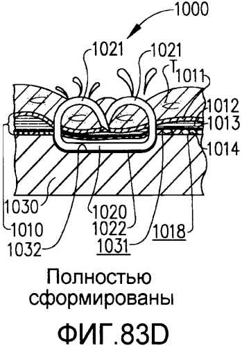 Имплантируемая кассета с крепежными элементами, содержащая опорный фиксатор (патент 2576225)