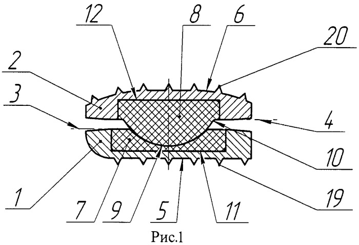 Протез межпозвоночного диска (патент 2465870)