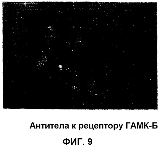 Получение гамкергических нейронов in vitro из эмбриональных стволовых клеток и их применение при лечении неврологических расстройств (патент 2380410)