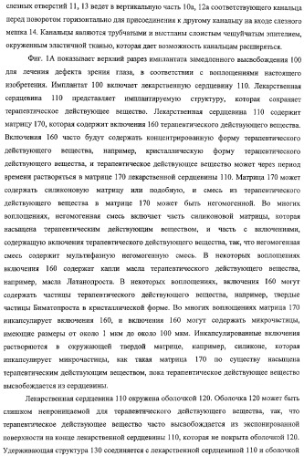 Способы доставки лекарственных средств, структуры и композиции для носослезной системы (патент 2413480)