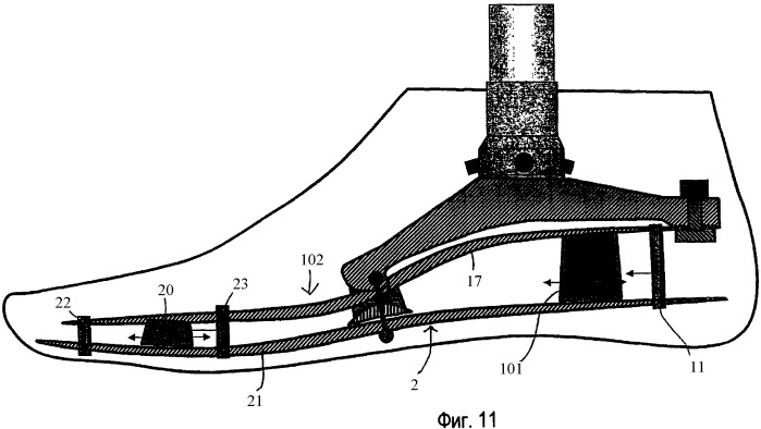 Искусственная стопа и способ управления ее движением (патент 2419398)