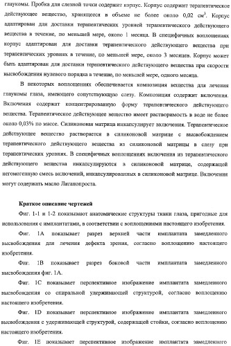 Способы доставки лекарственных средств, структуры и композиции для носослезной системы (патент 2413480)