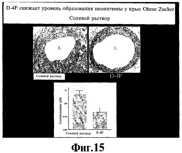 Обладающий способностью облегчать по меньшей мере один симптом воспалительного состояния пептид, содержащая его фармацевтическая композиция и способ лечения атеросклероза с их помощью (патент 2448977)