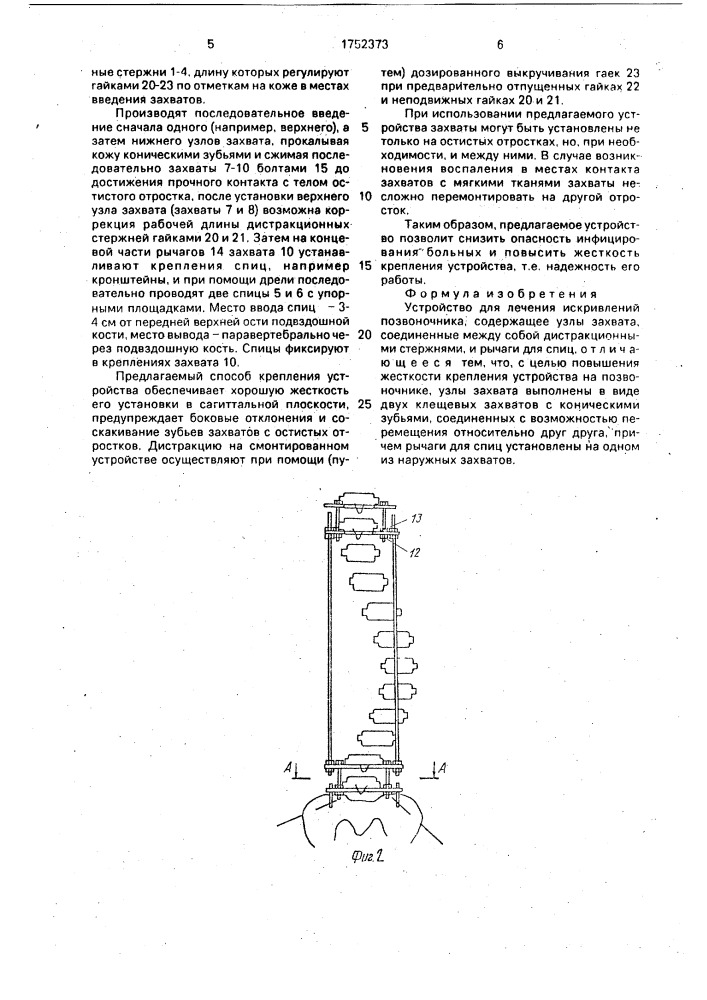 Устройство для лечения искривлений позвоночника (патент 1752373)