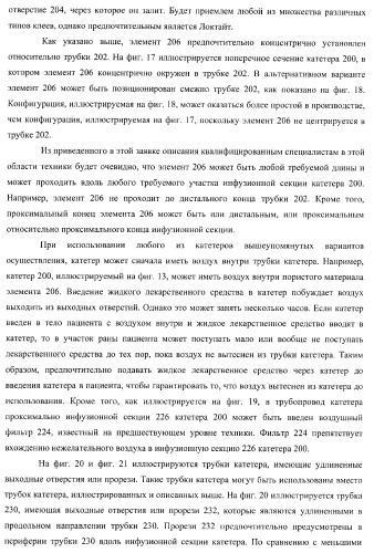 Катетер для равномерной подачи лекарственного средства (патент 2366465)