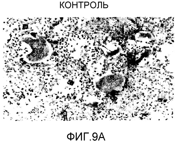 Полипептиды, селективные в отношении интегрина αvβ3, конъюгированные с вариантом челевеческого сывороточного альбумина (hsa), и их фармацевтические применения (патент 2547592)