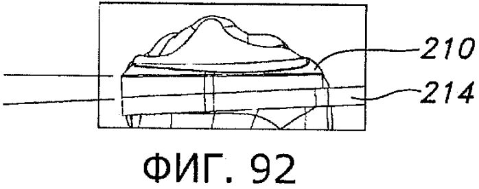 Способы и устройства для артропластики коленного сустава (патент 2570313)