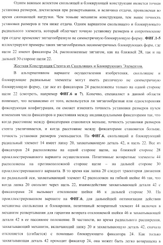 Стент из скользящих и блокирующих элементов (патент 2429801)