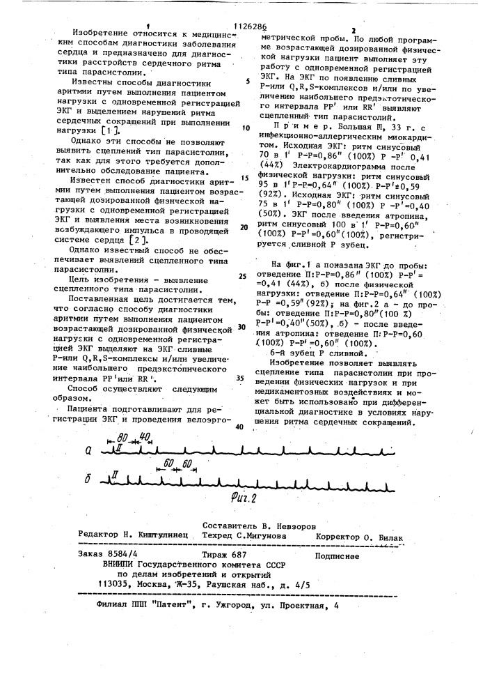 Способ диагностики аритмии (патент 1126286)