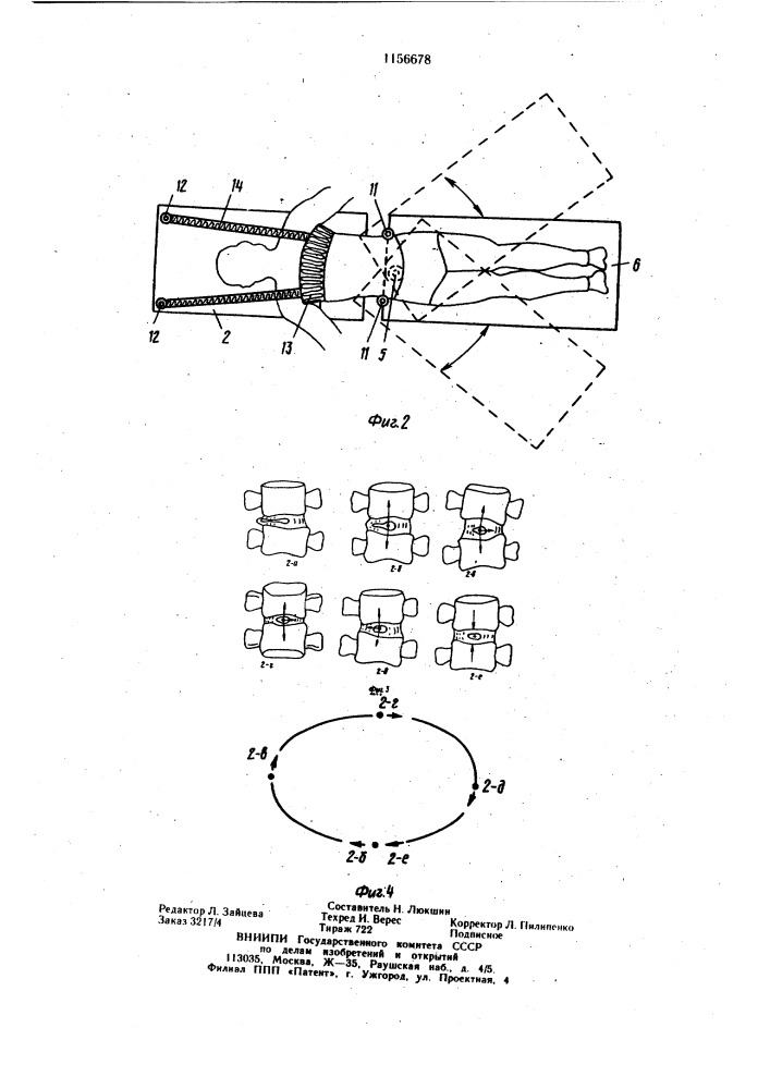Устройство для вправления грыж дисков позвонков (патент 1156678)