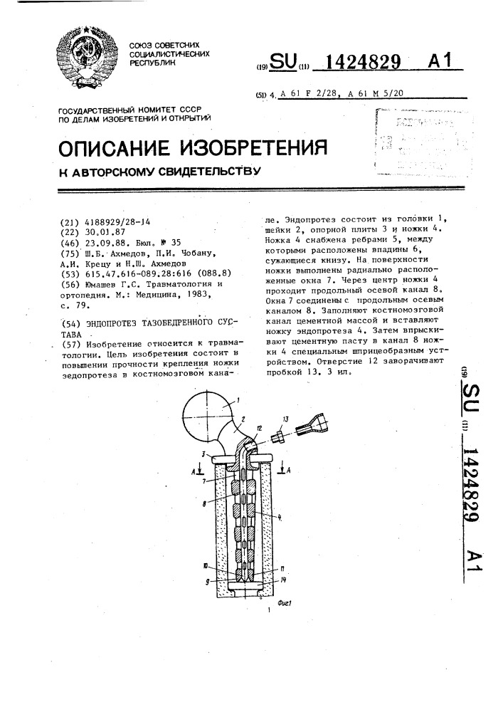 Эндопротез тазобедренного сустава (патент 1424829)