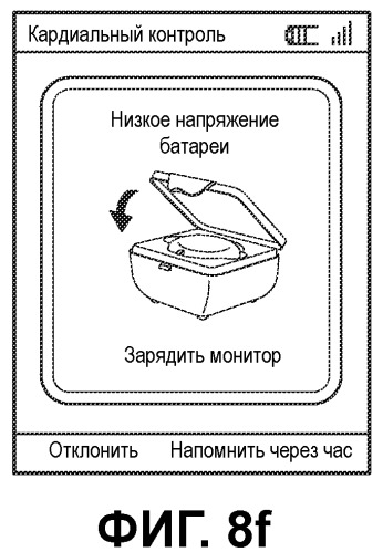 Система контроля экг с беспроводной связью (патент 2501520)
