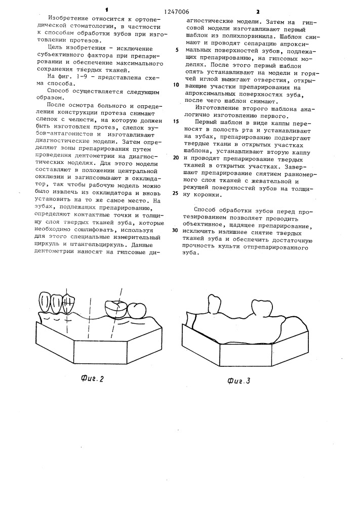 Способ обработки зубов перед протезированием (патент 1247006)