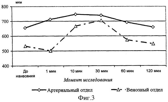 Средство для ухода за ногами при хронической венозной недостаточности нижних конечностей (патент 2359690)