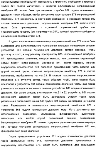 Устройство для лечения путем подкожной подачи пониженного давления с использованием текучей магистрали и связанный с ним способ (патент 2405459)