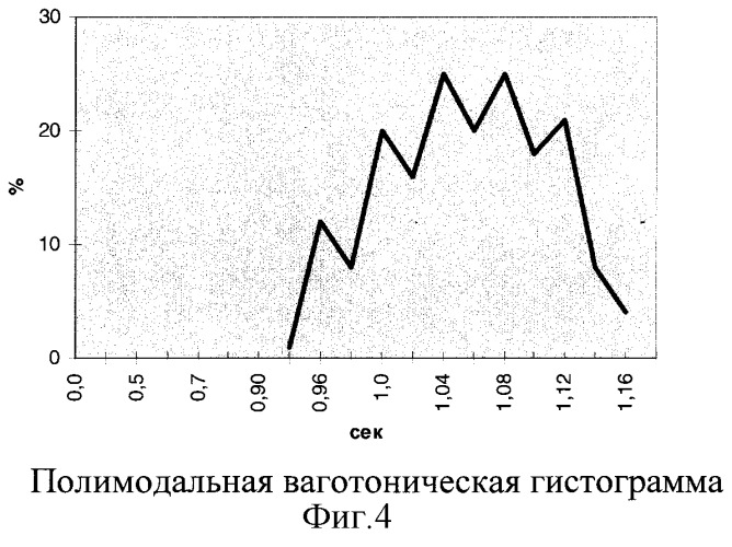 Способ оценки эффективности лечения у больных безболевой ишемией миокарда с различными типами вегетативной направленности (патент 2276574)