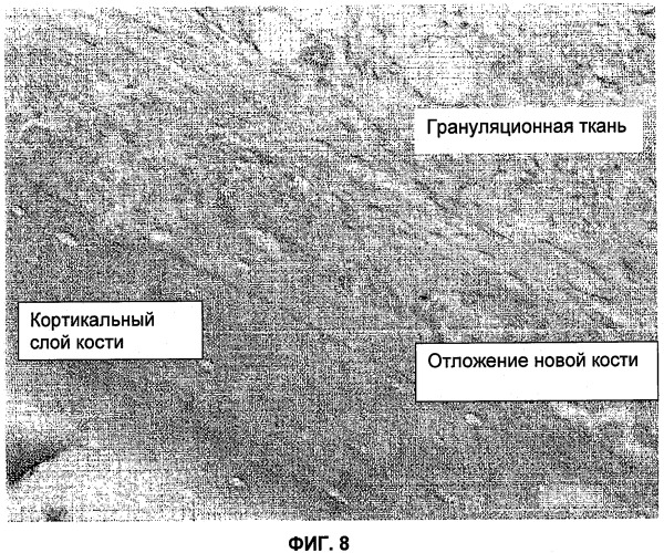 Активация образования костей и хрящей (патент 2447878)