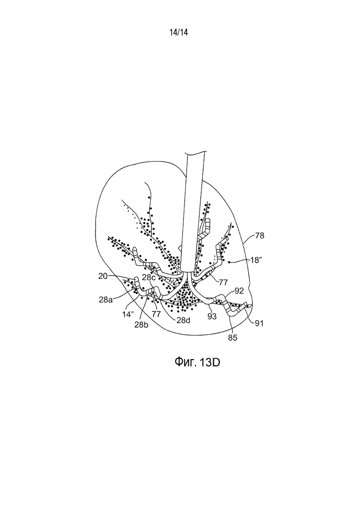 Цветковый катетер для картирования и абляции венозных и иных трубчатых областей (патент 2633325)