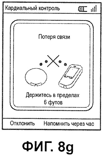 Система контроля экг с конфигурируемыми пределами включения сигналов тревоги (патент 2499550)