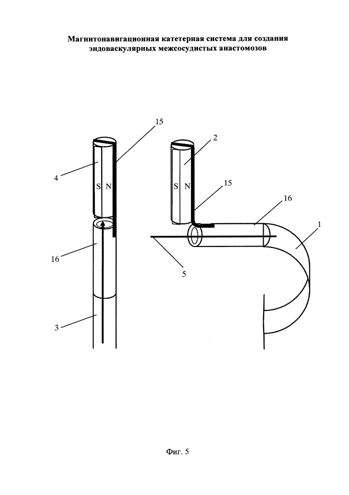 Магнитонавигационная катетерная система для создания эндоваскулярных межсосудистых анастомозов (патент 2662414)