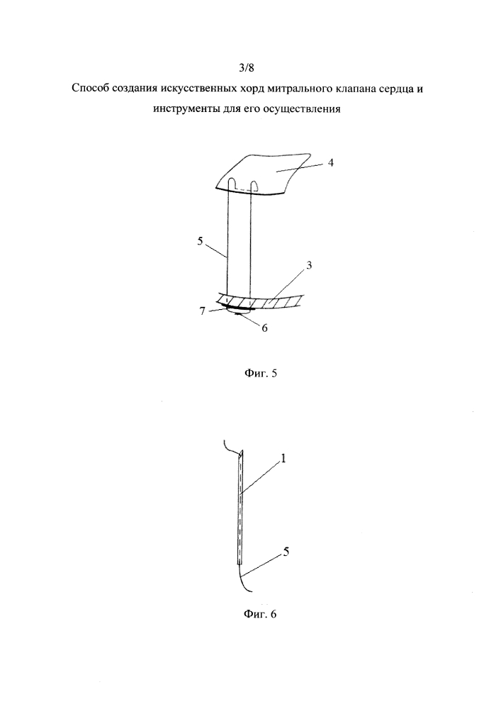 Способ создания искусственных хорд митрального клапана сердца и инструменты для его осуществления (патент 2654075)