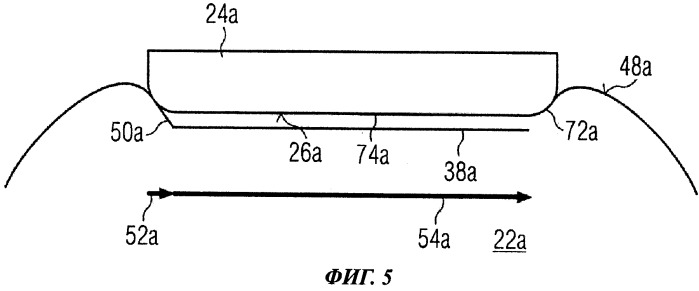 Устройство для разреза роговицы глаза человека (патент 2529391)