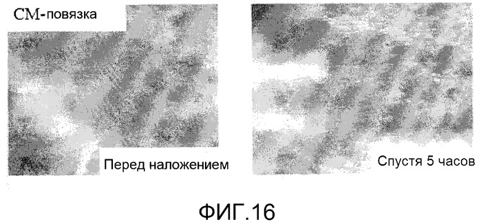 Повязка для лечения кожных заболеваний и облегчения симптомов кожных болезней, вызывающих экссудацию белков крови (патент 2524628)