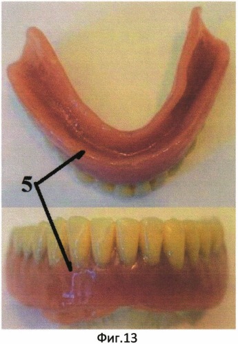 Способ формирования тонкопленочного защитного покрытия на базисах съемных зубных протезов, обтураторах и компонентах челюстно-лицевых протезов (патент 2540227)