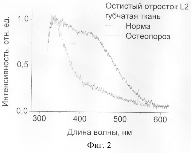 Способ диагностики остеопороза методом лазерно-индуцированной флуоресценции (патент 2244292)