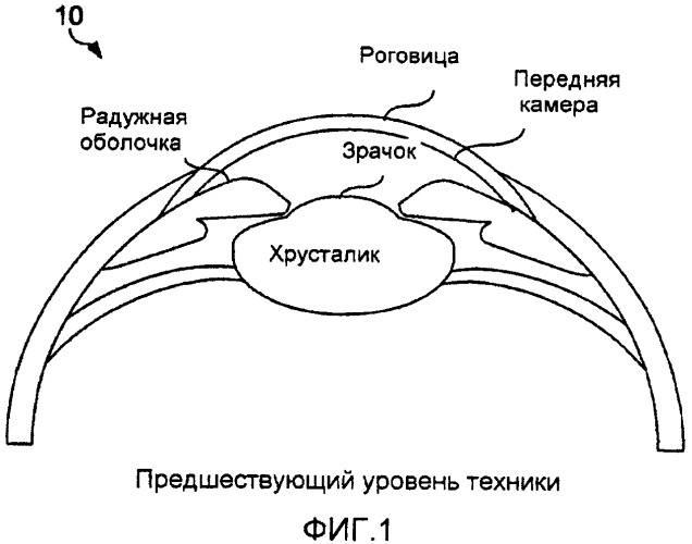 Выравнивание торических линз с использованием предоперационных изображений (патент 2489121)