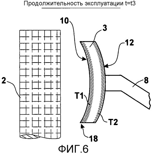 Форкамерная свеча зажигания (патент 2545520)