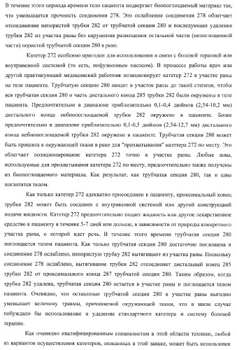 Катетер для равномерной подачи лекарственного средства (патент 2366465)