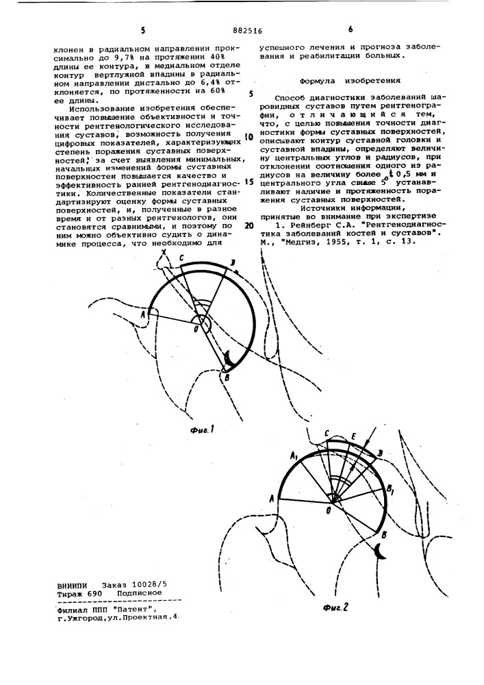 Способ диагностики заболеваний шаровидных суставов (патент 882516)
