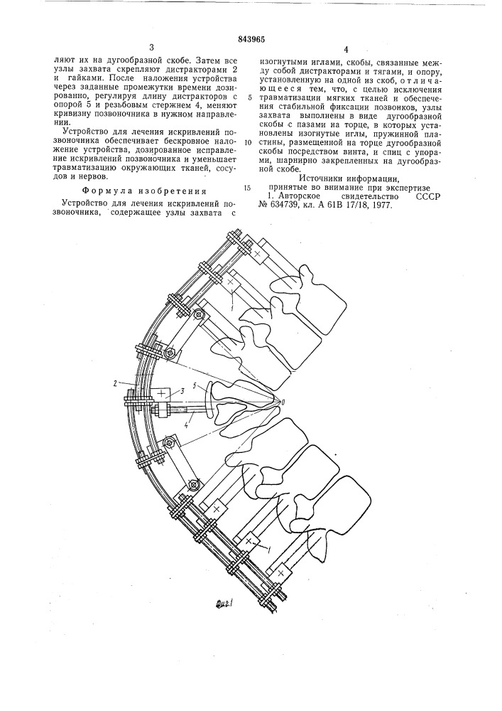 Устройство бызовых для леченияискривлений позвоночника (патент 843965)