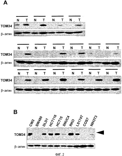 Связанный с раком толстого кишечника ген том34 (патент 2526196)