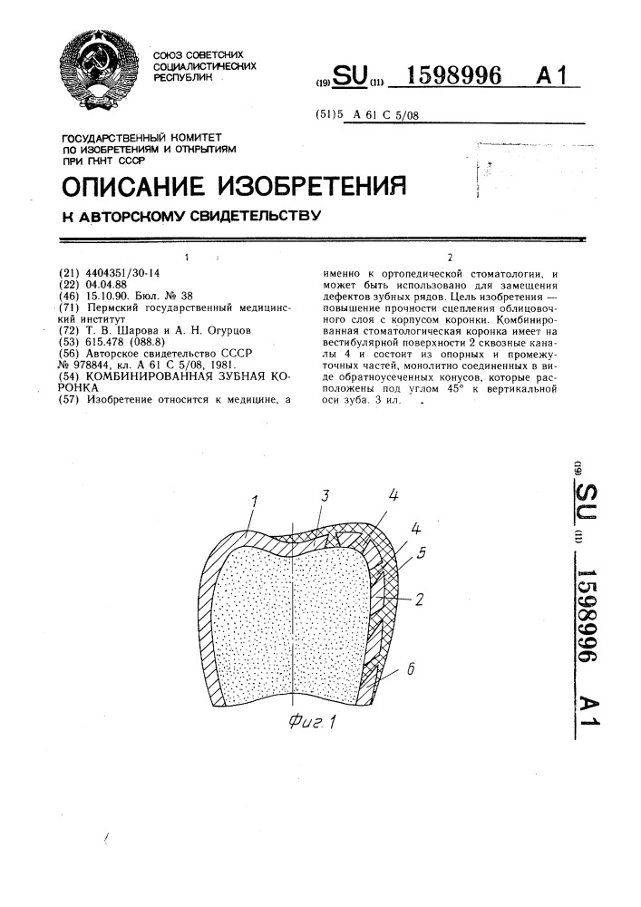 Комбинированная зубная коронка (патент 1598996)
