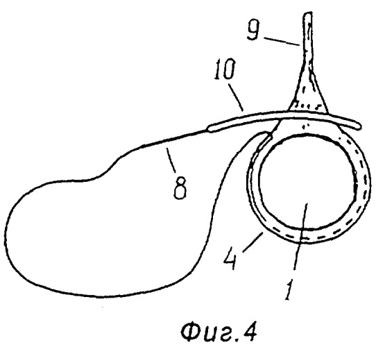 Способ перекрытия просвета кишки в эксперименте (патент 2278697)