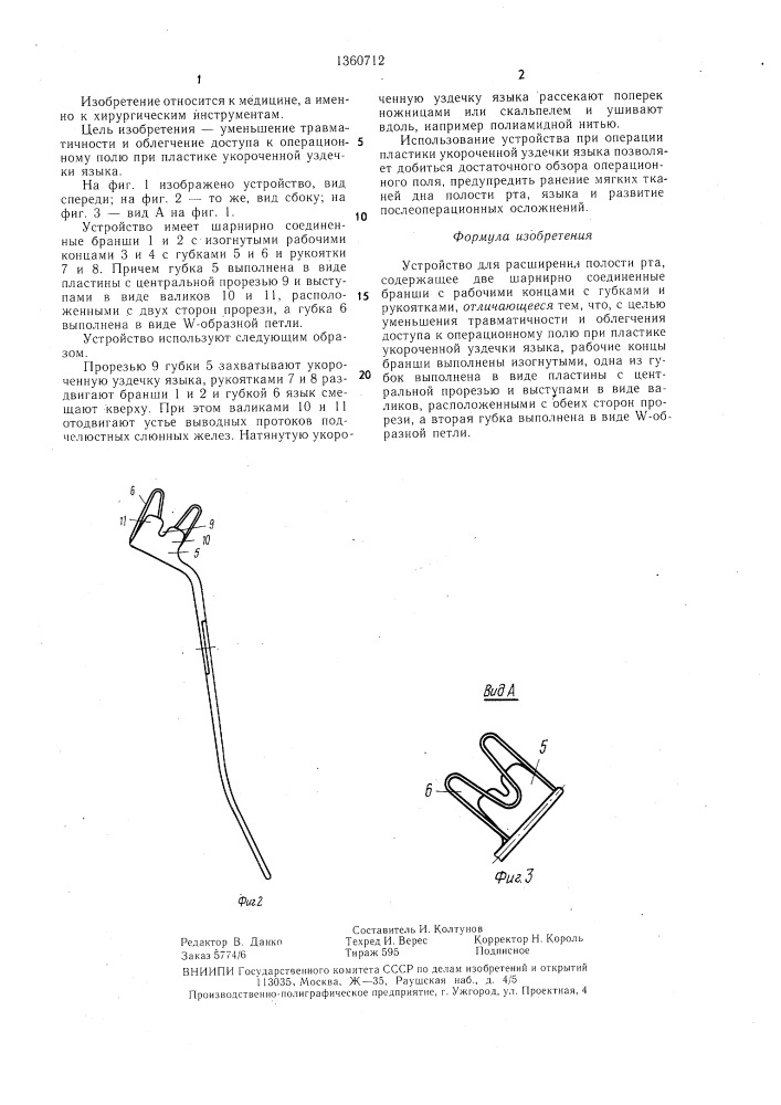 Устройство в.и.щербахи и а.и.богатова для расширения полости рта (патент 1360712)