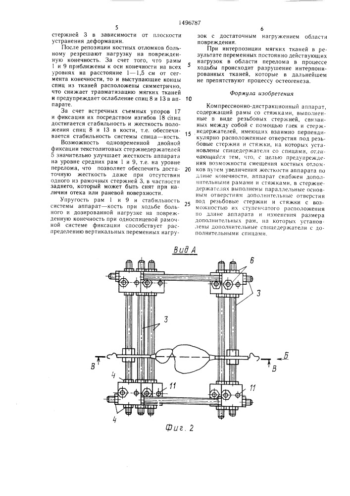 Компрессионно-дистракционный аппарат (патент 1496787)