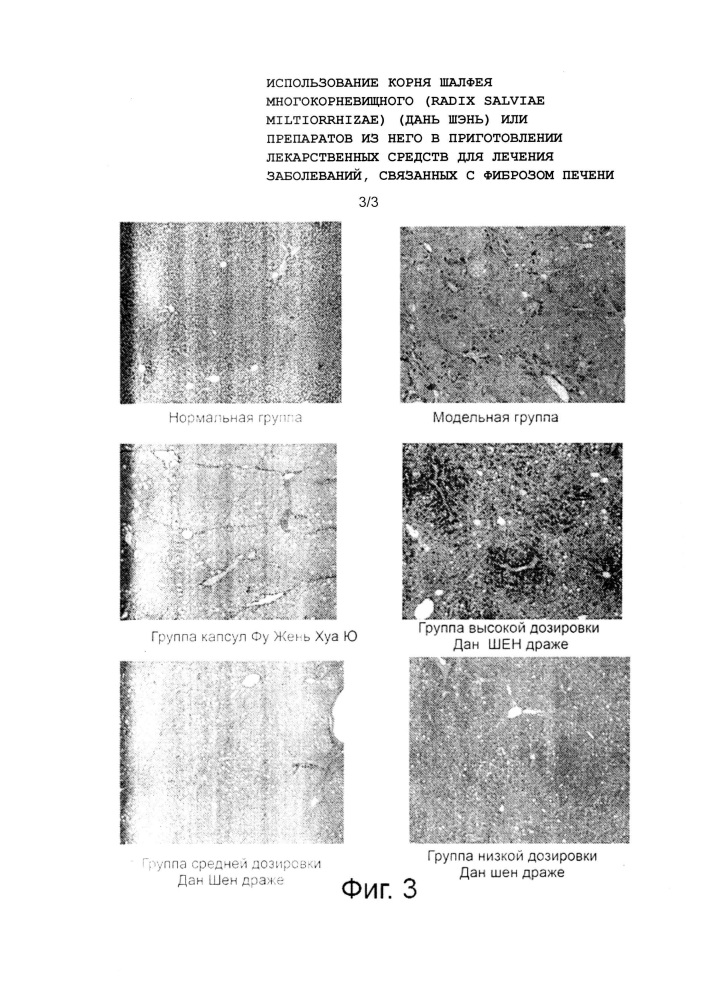 Использование корня шалфея многокорневищного (radix salviae miltiorrhizae) (дань шэнь) или препаратов из него в приготовлении лекарственных средств для лечения заболеваний, связанных с фиброзом печени (патент 2623147)