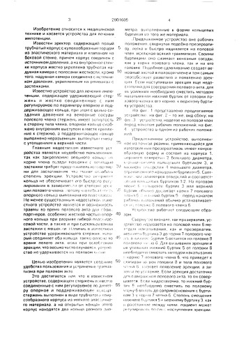 Устройство для лечения импотенции (патент 2001605)