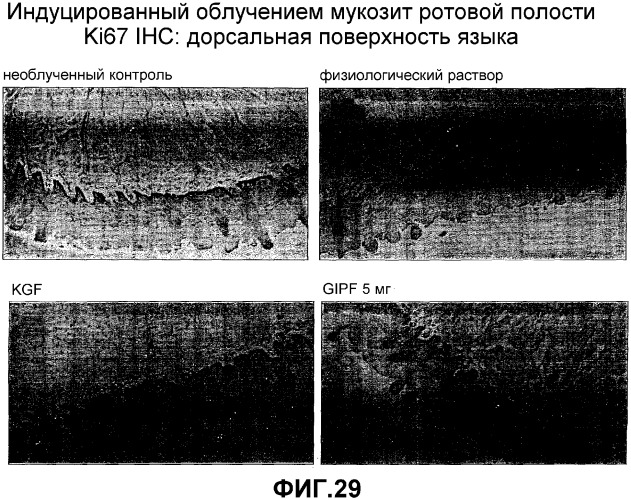 Желудочно-кишечный пролиферативный фактор и его применения (патент 2343158)