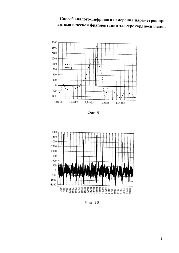 Способ аналого-цифрового измерения параметров при автоматической фрагментации электрокардиосигналов (патент 2636905)