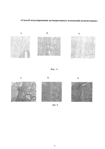 Способ моделирования дегенеративных изменений позвоночника (патент 2584136)