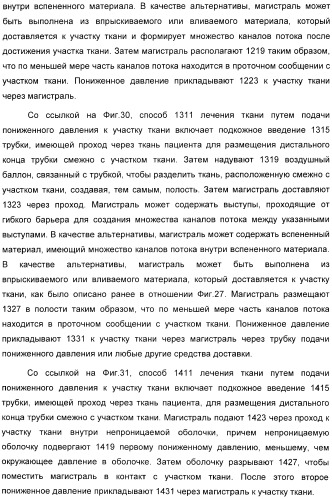 Устройство для лечения путем подкожной подачи пониженного давления с использованием разделения с помощью воздушного баллона (патент 2401652)