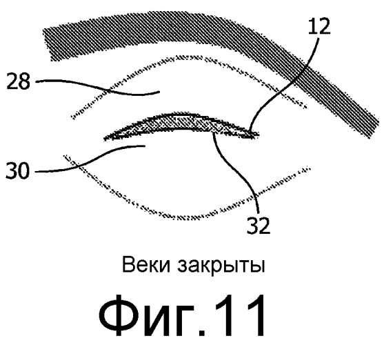 Система для доставки электромагнитного излучения в глазное яблоко субъекта (патент 2567263)