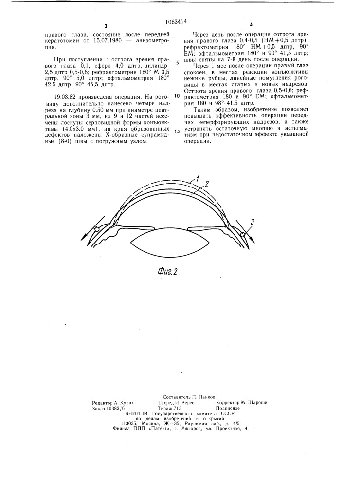 Способ лечения миопии и миопического астигматизма (патент 1063414)